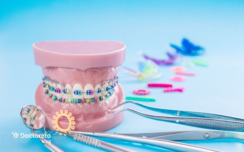 نحوه انجام ارتودنسی به چه صورت است؟