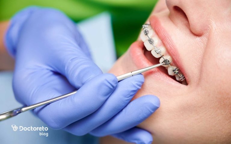 ارتودنسی: همه چیز درباره ارتودنسی و کاربردهای آن