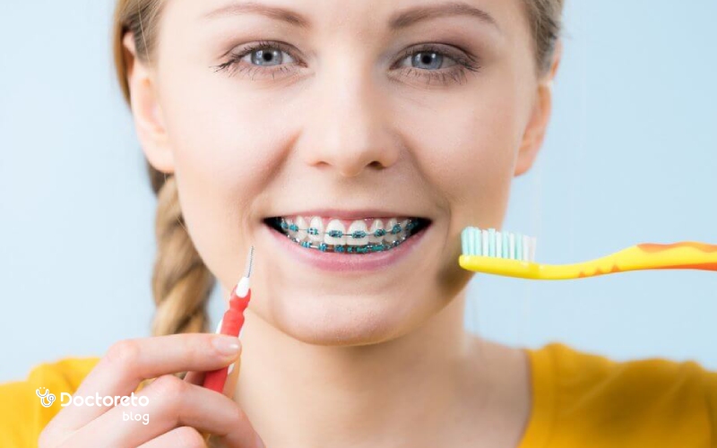 مسواک مخصوص ارتودنسی چیست و چه کاربردی دارد؟