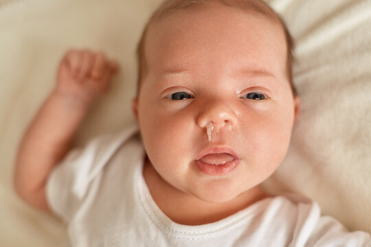 آبریزش بینی در نوزاد به چه علت است؟