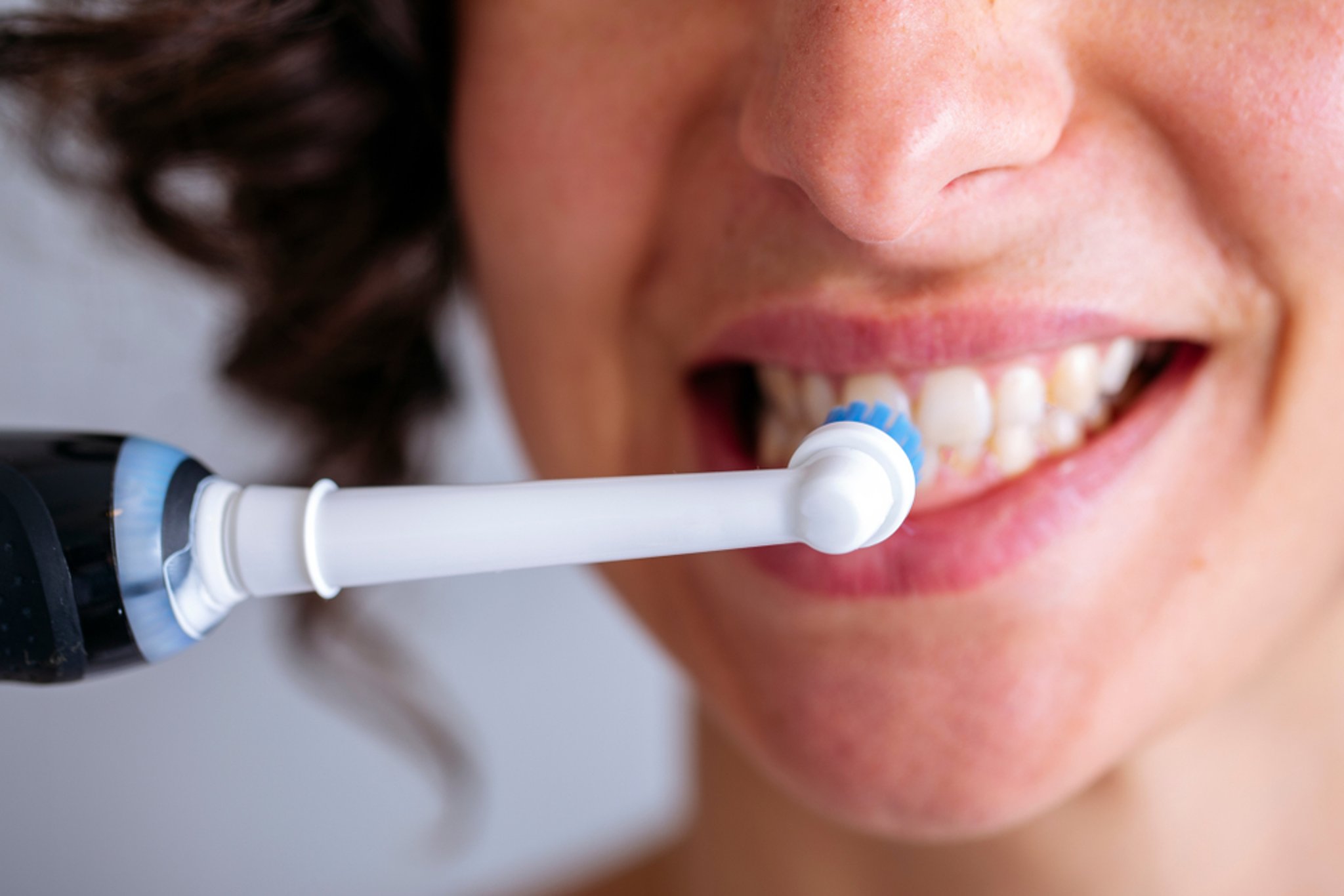 dental implant after care