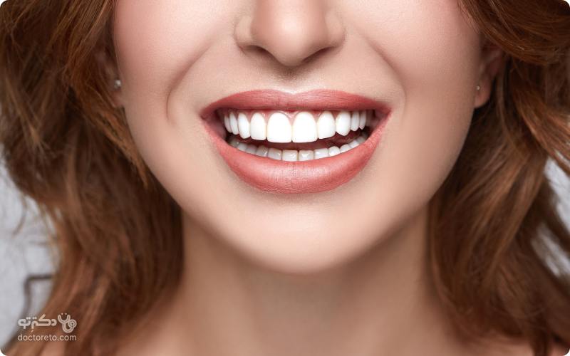 ۸ روش سفید کردن دندان که باید بدانید