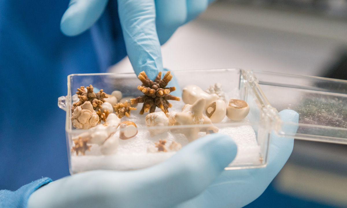 kidney stones types