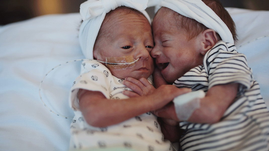 Preterm delivery of twins