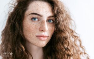 دلایل ایجاد کک و مک چیست؟