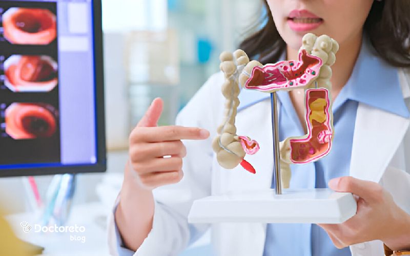 اقدامات قبل از آندوسکوپی