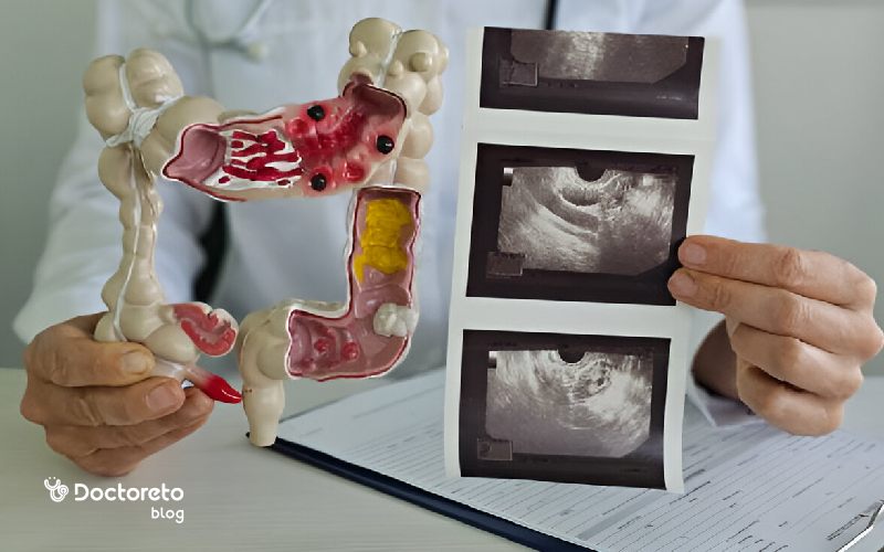 آندوسکوپی چیست و چگونه انجام میشود؟