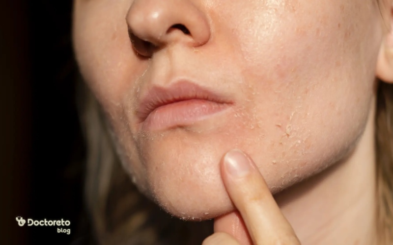 خشکی پوست صورت و بدن نشانه چیست و چطور برطرف میشود؟