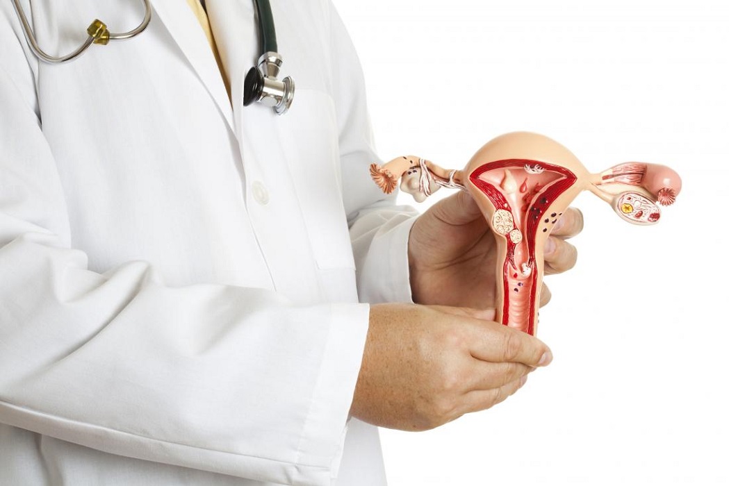 Uterine polyps vs fibroid