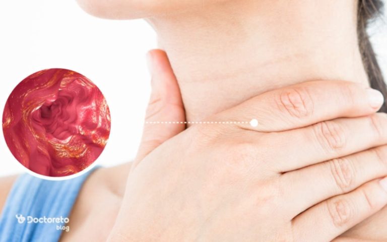 التهاب مری یا ازوفاژیت نشانه چیست و چه علائمی دارد؟