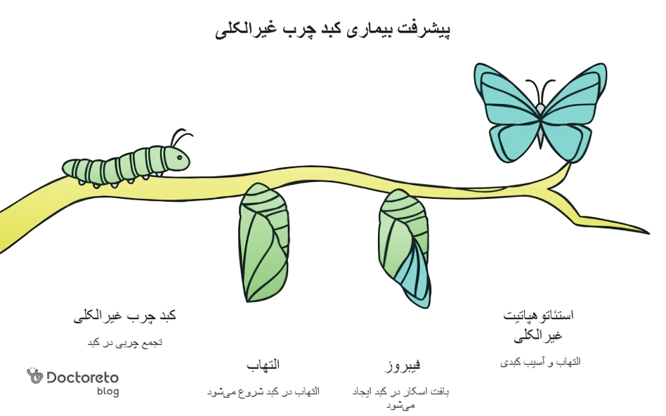 مراحل کبد چرب غیر الکلی