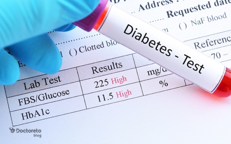 معرفی ۱۳ آزمایش ضروری در چکاپ برای افراد دیابتی