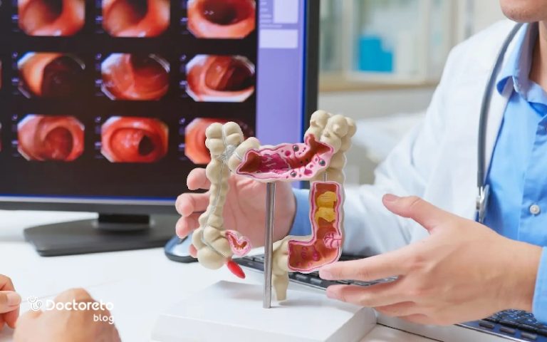 تشخیص سرطان روده چگونه انجام میشود؟