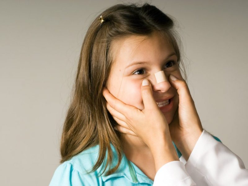 علائم شکستگی بینی در کودکان