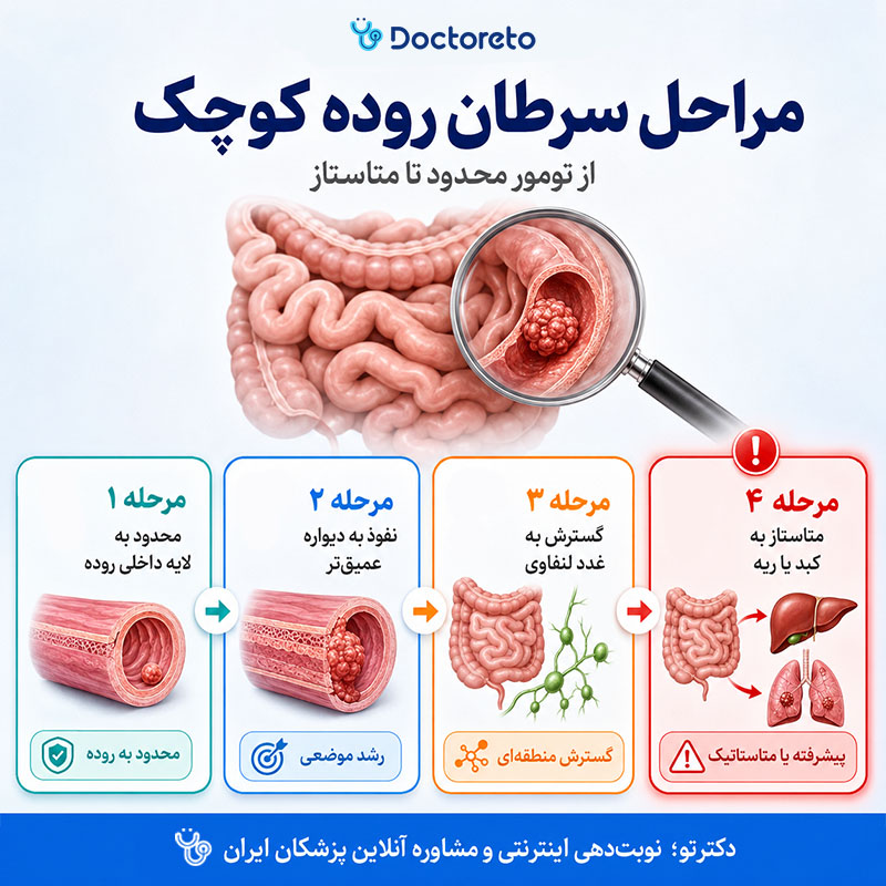 اینفوگرافیک سرطان روده کوچک
