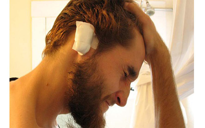 اگر درد گوش با وجود مصرف مسکن ها شدید است، حتما به پزشک خود اطلاع دهید.