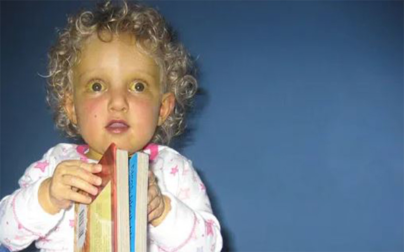 معمولا سندرم آلاژیل قبل از یک سالگی کودک تشخیص داده می‌شود. 