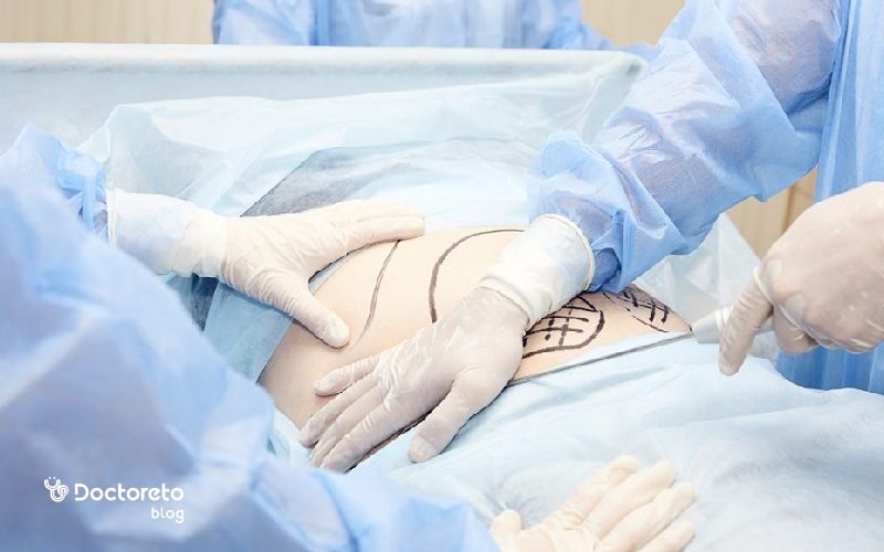 عمل لیپوماتیک چیست و چه عوارضی دارد؟