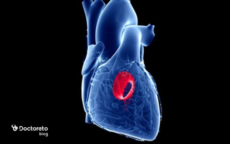 افتادگی دریچه میترال قلب چیست و چگونه درمان می شود؟