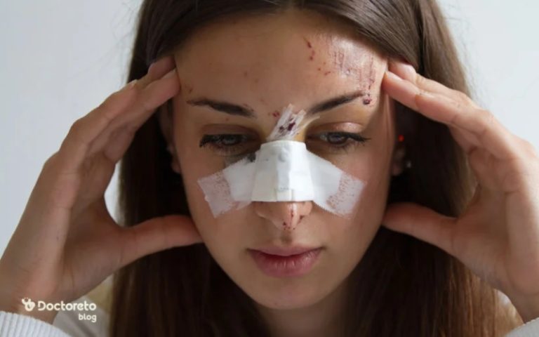 نکاتی که باید درباره شکستگی بینی بدانید