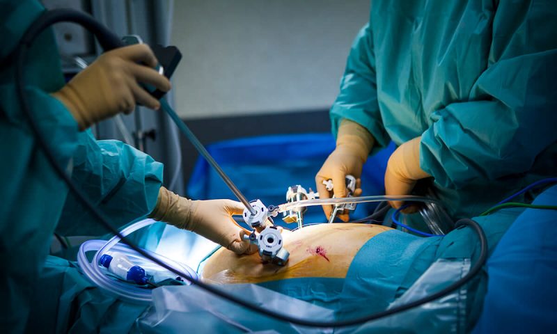 جراحی برای درمان سرطان گردن رحم
