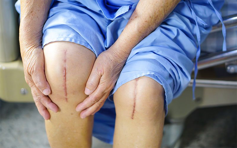 پس از بهبود زخم‌ها می‌توان بدون درد هر نوع فعالیت بدنی را انجام داد. 