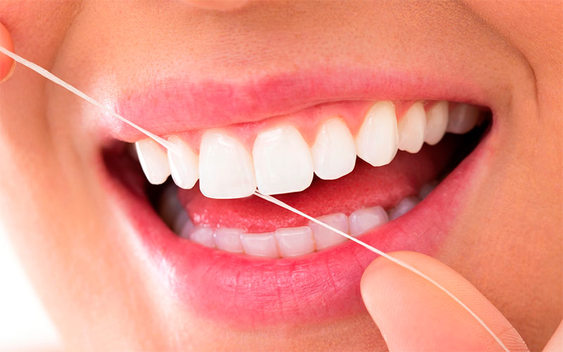 از نخ دندان برای تمیز کردن کامل اطراف ایمپلنت استفاده کنید.
