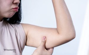 نکاتی که باید درباره مزایا و مراقبت های بعد از لیفت بازو با لیزر بدانید