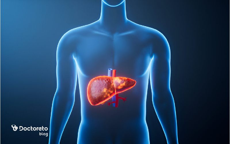 همه چیز در مورد سیروز صفراوی اولیه و ثانویه