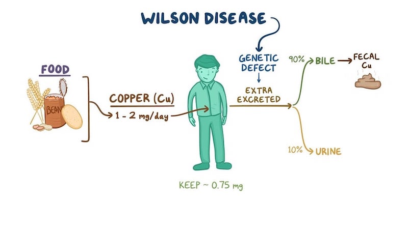 بیماری ویلسون چیست