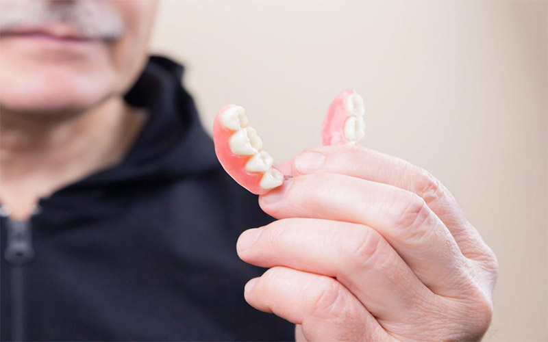 Trong phương pháp làm răng giả, phục hình răng có tính di động và có thể dễ dàng làm sạch. 