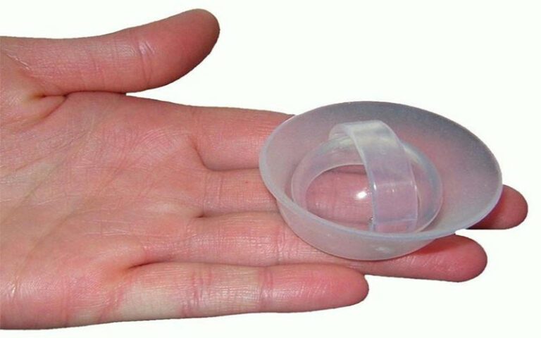 کلاهک دهانه رحم چیست؟ مزایا، معایب و نحوه استفاده از آن