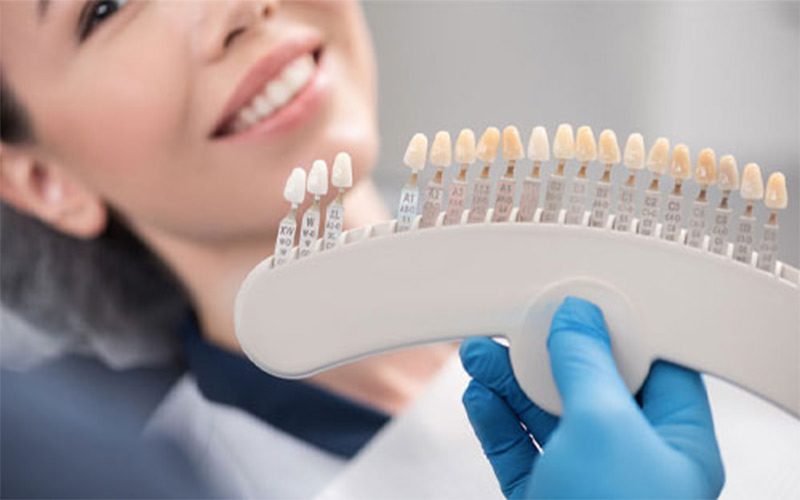 Mặt dán sứ hoàn toàn giống với răng tự nhiên và thích hợp để cấy ghép răng cửa.
