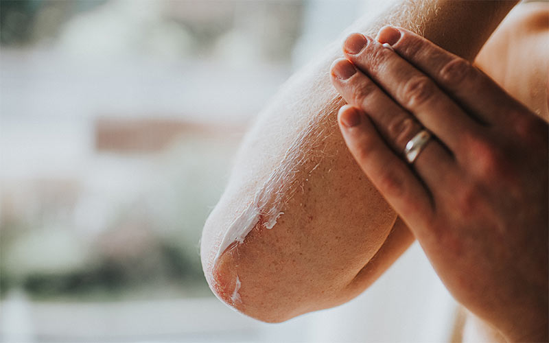 برای درمان خشکی پوست در حاملگی می‌توانید از کرم مرطوب‌کننده و آب‌رسان استفاده کنید. 