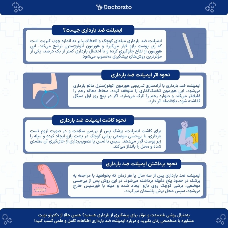اینفوگرافی ایمپلنت ضد بارداری