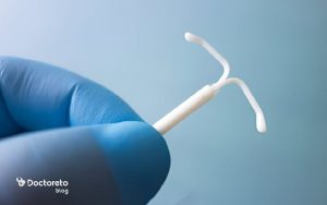 دستگاه آی یو دی هورمونی؛ مزایا، عوارض و نحوه گذاشتن iud