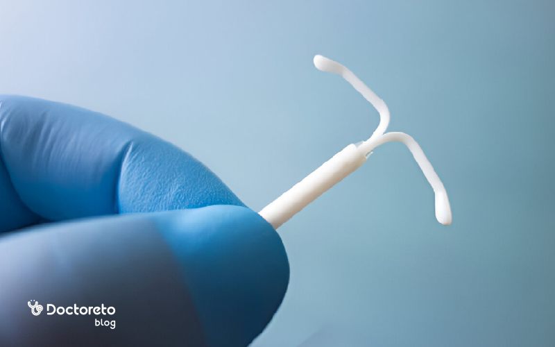 دستگاه آی یو دی هورمونی؛ مزایا، عوارض و نحوه گذاشتن iud