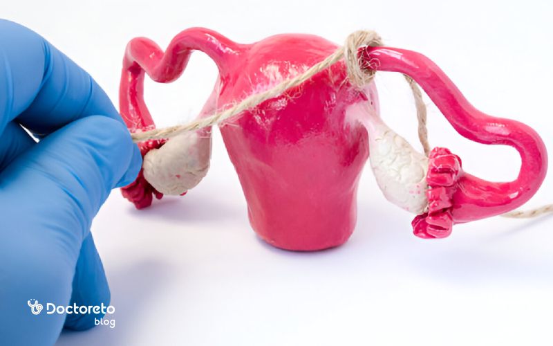 بستن لوله های رحم؛ مزایا و عوارض توبکتومی