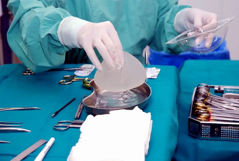 عمل جراحی پروتز سینه