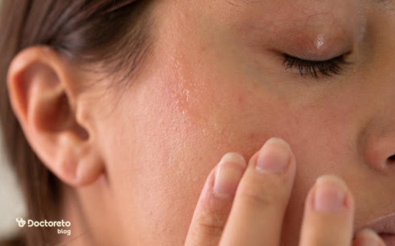 نکاتی که باید درباره خشکی پوست در بارداری بدانید