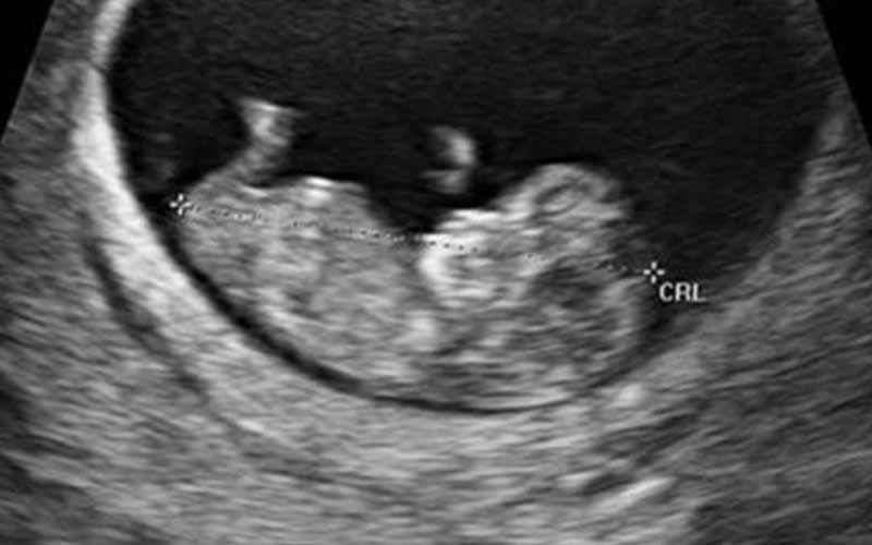 شما می‌توانید در این هفته حرکت جنین را در سونوگرافی مشاهده کنید.