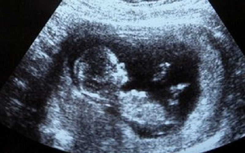 در سونوگرافی هفته 11 بارداری ضربان قلب شنیده شده و حرکات جنین دیده می‌شود.