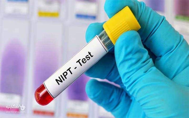 نمونه خون برای آزمایش NIPT