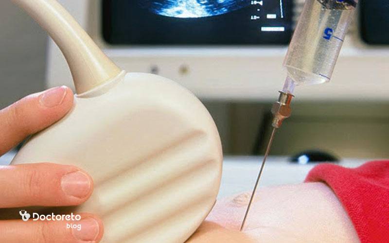 باید و نبایدهای هفته نوزدهم بارداری