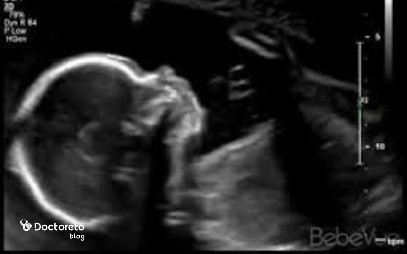 سونوگرافی هفته 24 بارداری