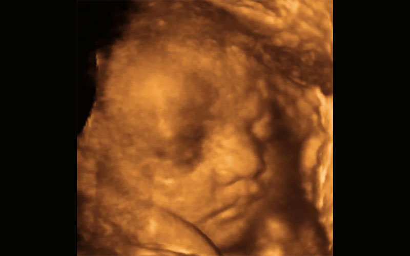 در این تصویر می‌توانید جنین ۳۵ هفته را در سونوگرافی سه بعدی مشاهده کنید.