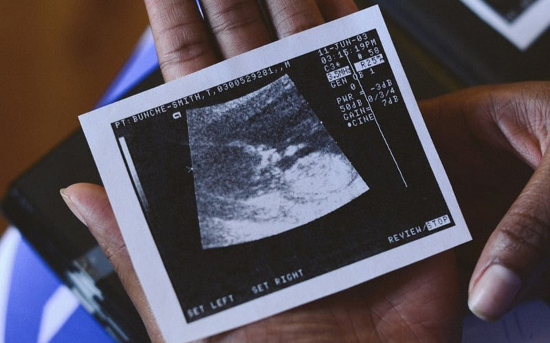در این تصویر می‌توانید سونوگرافی جنین را در هفته 37 بارداری مشاهده کنید.