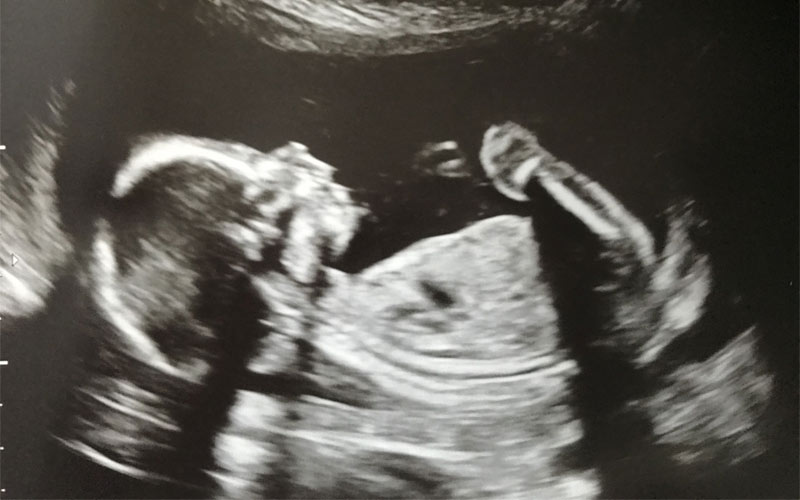 در این تصویر می‌توانید جنین نوزده هفته را در سونوگرافی مشاهده کنید.