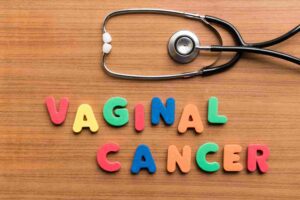 نشانه های سرطان واژن چیست