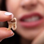 پوسیدگی دندان، از تشخیص تا بهترین روش های درمان